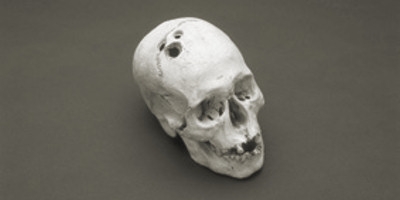 trepanning1.jpg