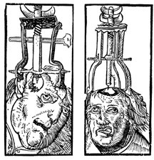trepanning2.jpg
