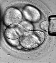 24stem190.1.jpg