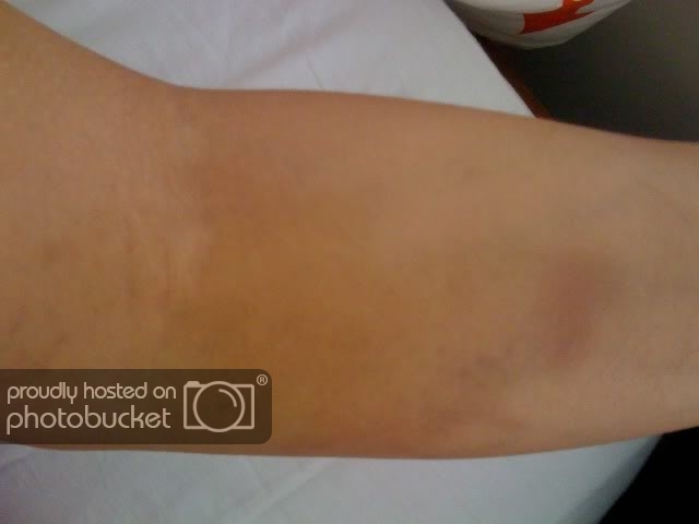 forearm.jpg