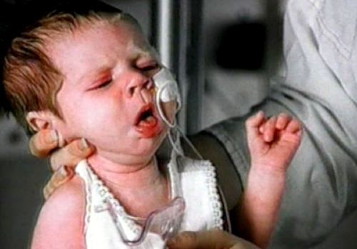 whooping-cough-EC.png