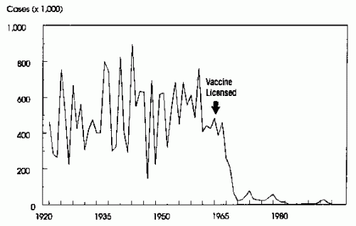 measles.gif