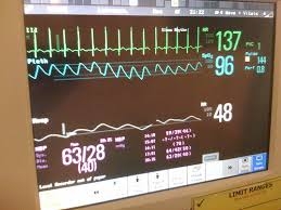 Blood Pressure Monitor