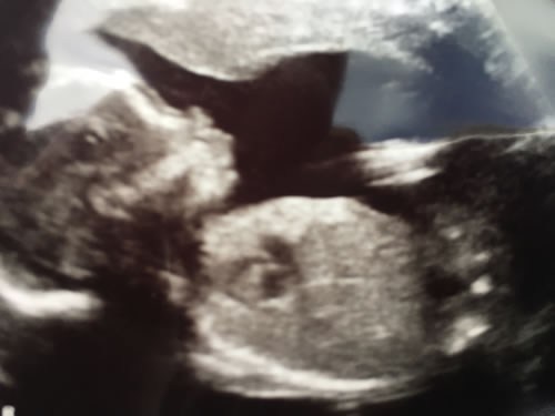 sonogram.jpg.8480eb45ea4543db81db6cad414804c6.jpg