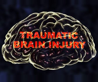 Anything but Fine: My Traumatic Brain Injury: Part 2