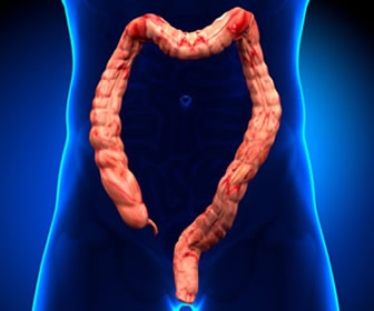 Irritable Bowel Syndrome- The Back End Story