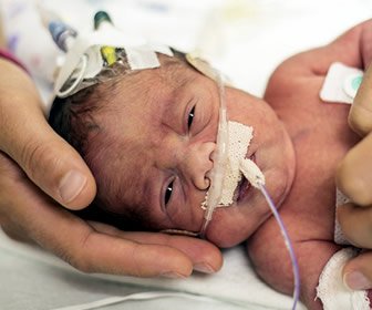 Our Littlest Patient