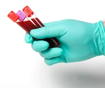 Blood Collection Variables are a Risk to Patients