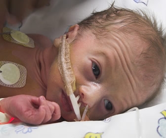 Evidence-Based Practice by Nurses for Nurses: Encouraging Waiting Spontaneous Labor