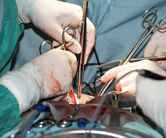 Life-Saving Surgeries : A Woman from Chadwicks - Part Two