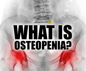 Osteopenia