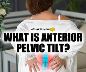 Anterior Pelvic Tilt: A Correctable Cause of Back Pain