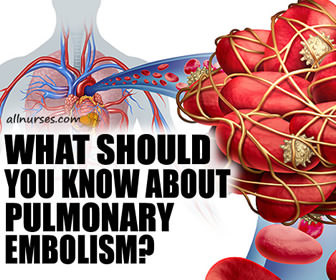 Pulmonary Embolism