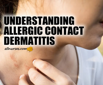 The Ins and Outs of Allergic Contact Dermatitis