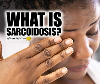 Sarcoidosis: A Complex Disease Simplified