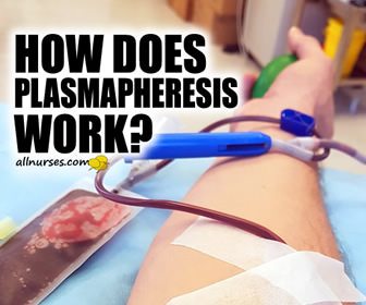 How does plasmapheresis work?