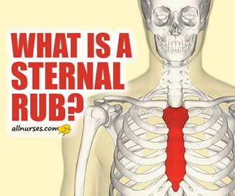 What is a Sternal Rub?