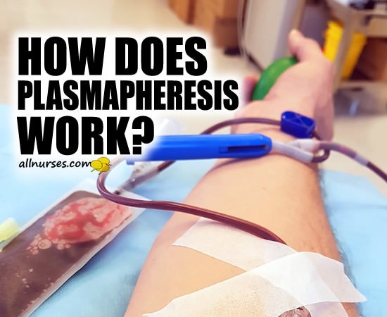What is Plasmapheresis?