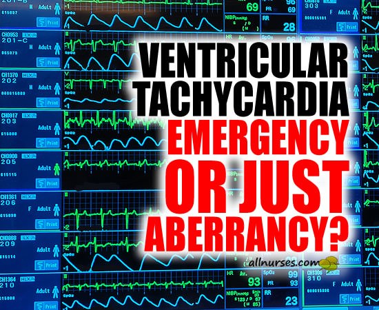 Is it VT? Deciphering Wide Complex Tachycardia